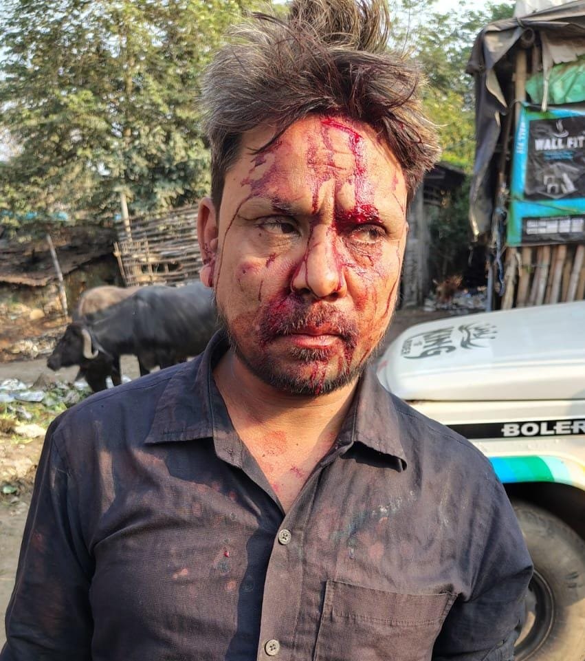 सब्जी विक्रेता पार जानलेवा हमला, गंभीर रूप से घायल,मामला दर्ज…