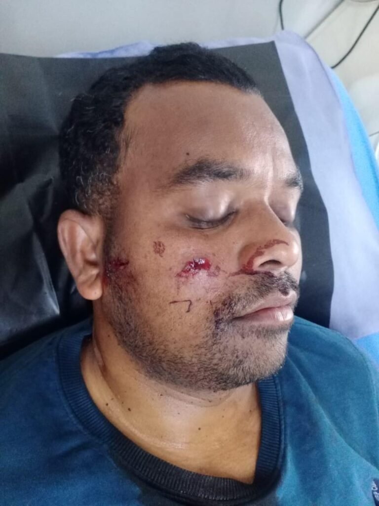 हाहाप पंचायत बीके मुखिया को लगी गोली , मेडिका में ईलाज के चल रहा…