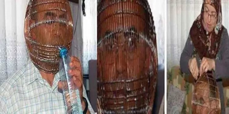 सिगरेट छोड़ने के लिए अपनाया अनोखा तरीका, चेहरे को पिंजरे में किया कैद…