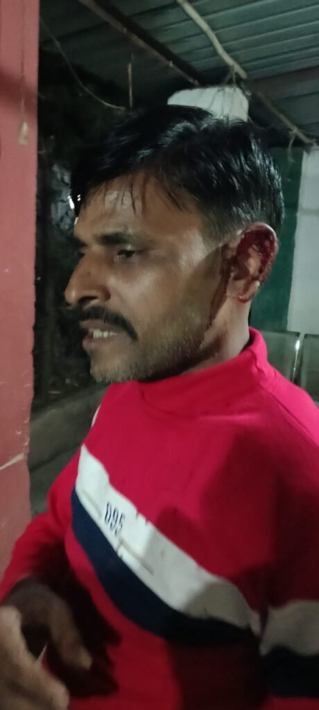 Dhanbad News : भूली में भांजे ने मामा पर की फायरिंग, कान जख्मी…