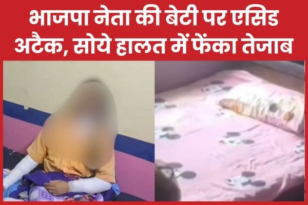 भाजपा नेता की बेटी पर ए’सिड अ’टैक, सोये हालत में फेंका ते’जाब…