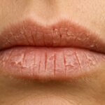 Lip Care Tips: सूखे और फटे होंठों से हैं परेशान? अपनाएं ये घरेलू उपाय, पाएंगे मुलायम और गुलाबी होंठ…