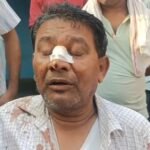 बराकर मे शराबीयों ने बस चालक को बेरहमी से पिटा लापरवाही से कार चलाने से मना कर रहा था बस चालक…