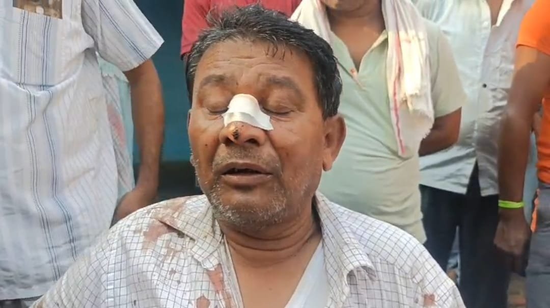 बराकर मे शराबीयों ने बस चालक को बेरहमी से पिटा लापरवाही से कार चलाने से मना कर रहा था बस चालक…