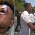 Ahmedabad Plane Crash: जाको राखे साइयां मार सके ना कोय… आग का गोला बने प्लेन से जिंदा बच निकला यह शख्स… जानें कैसे हुआ यह चमत्कार…