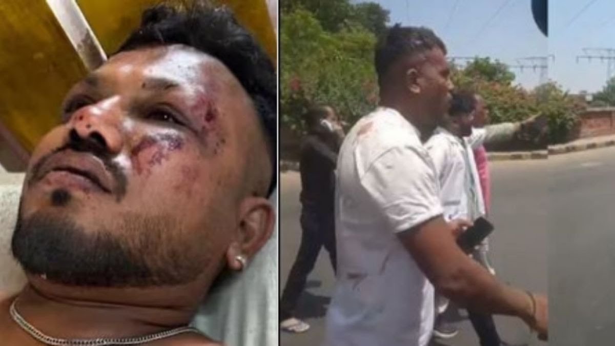 Ahmedabad Plane Crash: जाको राखे साइयां मार सके ना कोय… आग का गोला बने प्लेन से जिंदा बच निकला यह शख्स… जानें कैसे हुआ यह चमत्कार…