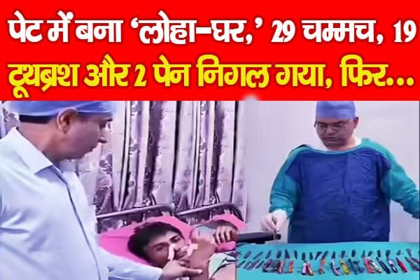 पेट में बना ‘लोहा-घर,’ 29 चम्मच, 19 टूथब्रश और 2 पेन निगल गया, फिर…