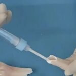 चीनी वैज्ञानिकों ने बनाया ‘बोन ग्लू’, केवल 3 मिनट में जोड़ेगा फ्रैक्चर!..