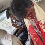 बंगाल मे भाजपा विधायक और सांसद पर जानलेवा हमला हुए लहूलुहान…