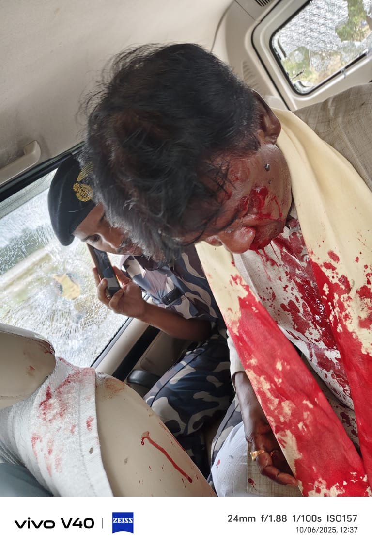 बंगाल मे भाजपा विधायक और सांसद पर जानलेवा हमला हुए लहूलुहान…