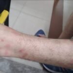 रेलवे के AC रिटायरिंग रूम में खटमलों की भरमार,गंगा-सतलज एक्सप्रेस के फर्स्ट एसी में सफर कर रहे ISM कर्मी के बेटे को ट्रेन में चूहे ने काटा…