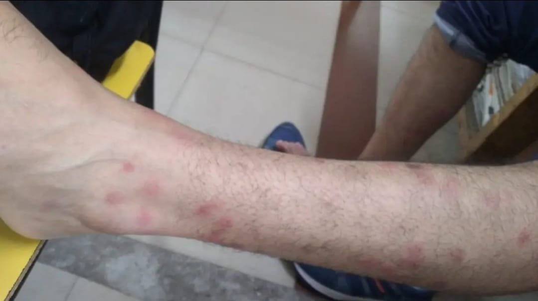 रेलवे के AC रिटायरिंग रूम में खटमलों की भरमार,गंगा-सतलज एक्सप्रेस के फर्स्ट एसी में सफर कर रहे ISM कर्मी के बेटे को ट्रेन में चूहे ने काटा…