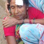 सांड के हमले से घायल हुई महिला,इधर गहरे नींद में सो रहा है नगर निगम प्रबंधन…