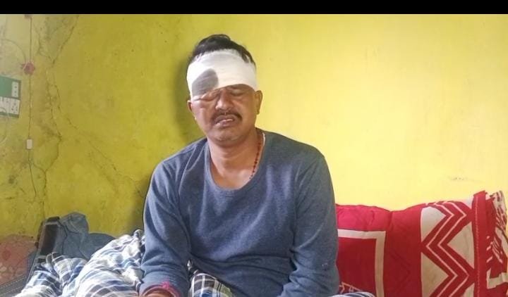 डूमरकुंडा उत्तर पंचायत मुखिया के ऊपर नकाबपोश चोरों ने पिस्टल के बट से मार कर किया घायल…