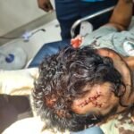 होली के दिन बरमसिया में डीजे के विवाद में हुई फायरिंग में दो घायल…पुलिस जांच में जुटी….