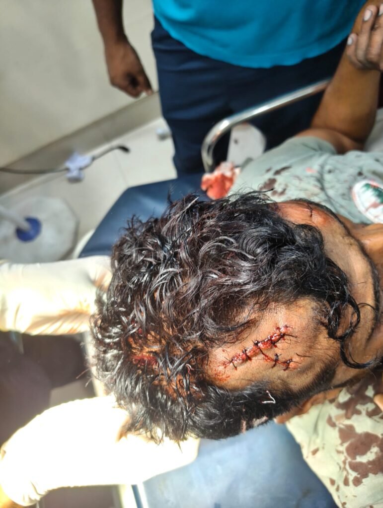 होली के दिन बरमसिया में डीजे के विवाद में हुई फायरिंग में दो घायल…पुलिस जांच में जुटी….