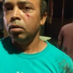 नियामतपुर हरिजन पाड़ा में मारपीट मामले में पुलिस का शिकंजा, छापेमारी से इलाके में हड़कंप…